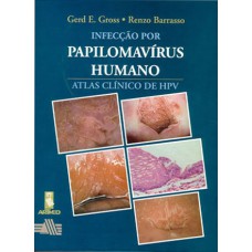 Infecção por Papilomavírus Humano Infecção por Papilomavírus Humano