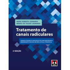 Tratamento de Canais Radiculares Tratamento de Canais Radiculares