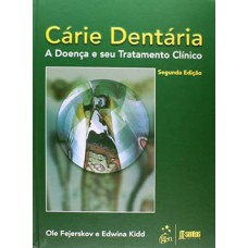 Cárie dentária Cárie dentária