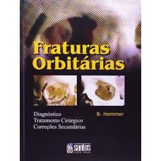 Fraturas orbitárias