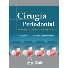 Cirugía periodontal Cirugía periodontal