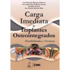 Carga imediata e implantes osteointegrados Carga imediata e implantes osteointegrados
