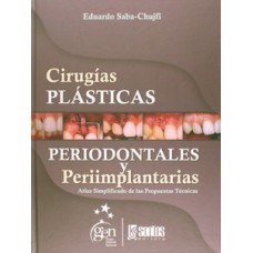 Cirugías plásticas periodontales y periimplantarias Cirugías plásticas periodontales y periimplantarias