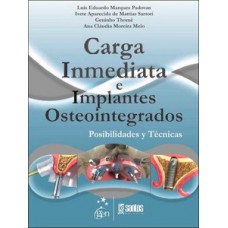 Carga inmediata e implantes osteointegrados Carga inmediata e implantes osteointegrados