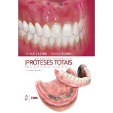 Clonagem terapêutica para próteses totais e overdentures Clonagem terapêutica para próteses totais e overdentures