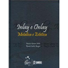 Inlay e Onlay - Metálica e estética Inlay e Onlay - Metálica e estética