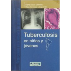 Tuberculosis en niños y jóvenes