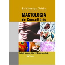 Mastologia de consultório Mastologia de consultório