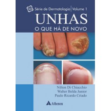 Unhas