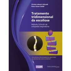 Tratamento tridimensional da escoliose Tratamento tridimensional da escoliose