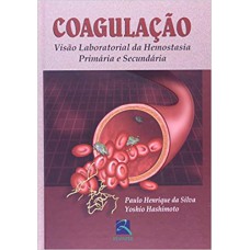 Coagulação Coagulação