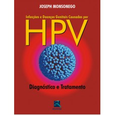 Infecções e Doenças Genitais Causadas por HPV Infecções e Doenças Genitais Causadas por HPV