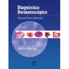 Diagnóstico Dermatoscópico Diagnóstico Dermatoscópico