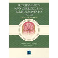 Procedimentos não Cirúrgicos no Rejuvenescimento Facial Procedimentos não Cirúrgicos no Rejuvenescimento Facial