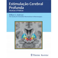 Estimulação Cerebral Profunda