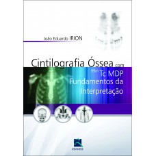 Cintilografia Óssea com 99M Tc MDP Cintilografia Óssea com 99M Tc MDP