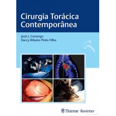 Cirurgia Torácica Contemporânea