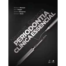 Newman e Carranza - Periodontia Clínica Essencial