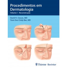Procedimentos em Dermatologia Procedimentos em Dermatologia