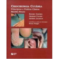 Criocirurgia cutânea Criocirurgia cutânea