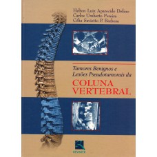 Tumores Benignos e Lesões Pseudotumorais da Coluna Vertebral