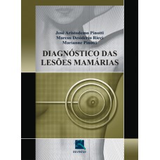 Diagnóstico das Lesões Mamárias Diagnóstico das Lesões Mamárias