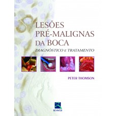 Lesões Pré Lesões Pré