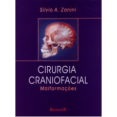Cirurgia Craniofacial Cirurgia Craniofacial
