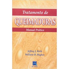 Tratamento de Queimaduras Tratamento de Queimaduras