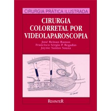 Cirurgia Colorretal por Videolaparoscopia Cirurgia Colorretal por Videolaparoscopia