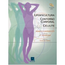 Lipoescultura, Contorno Corporal, Celulite Lipoescultura, Contorno Corporal, Celulite