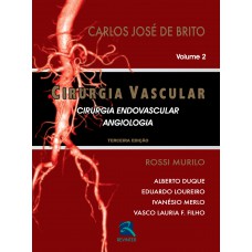 Cirurgia Vascular
