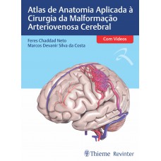 Atlas de Anatomia Aplicada à Cirurgia da Malformação Arteriovenosa Cerebral