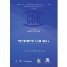 Coleção CBO - Neuroftalmologia Coleção CBO - Neuroftalmologia