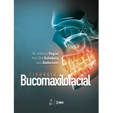 Cirurgia Bucomaxilofacial Cirurgia Bucomaxilofacial