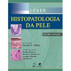 Lever - Histopatologia da Pele Lever - Histopatologia da Pele