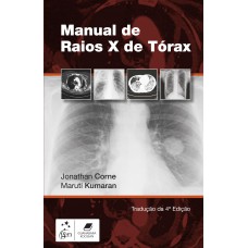 Manual de Raios-X de Tórax Manual de Raios-X de Tórax