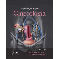 Diagnóstico por Imagem: Ginecologia