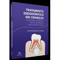 Tratamento endodôntico em crianças Tratamento endodôntico em crianças