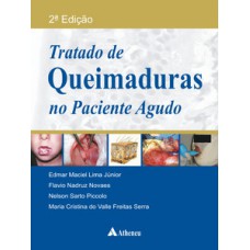 Tratado de queimaduras no paciente agudo