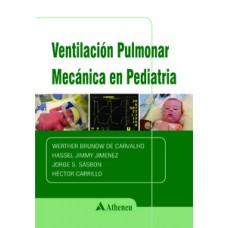 Ventilación pulmonar mecánica en pediatría