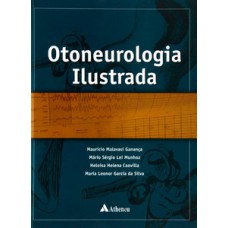 Otoneurologia ilustrada